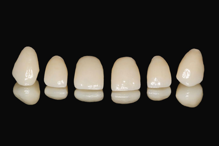 Dentist Bells Corners