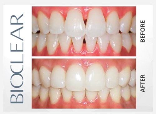 | Bells Corners Dental Studio